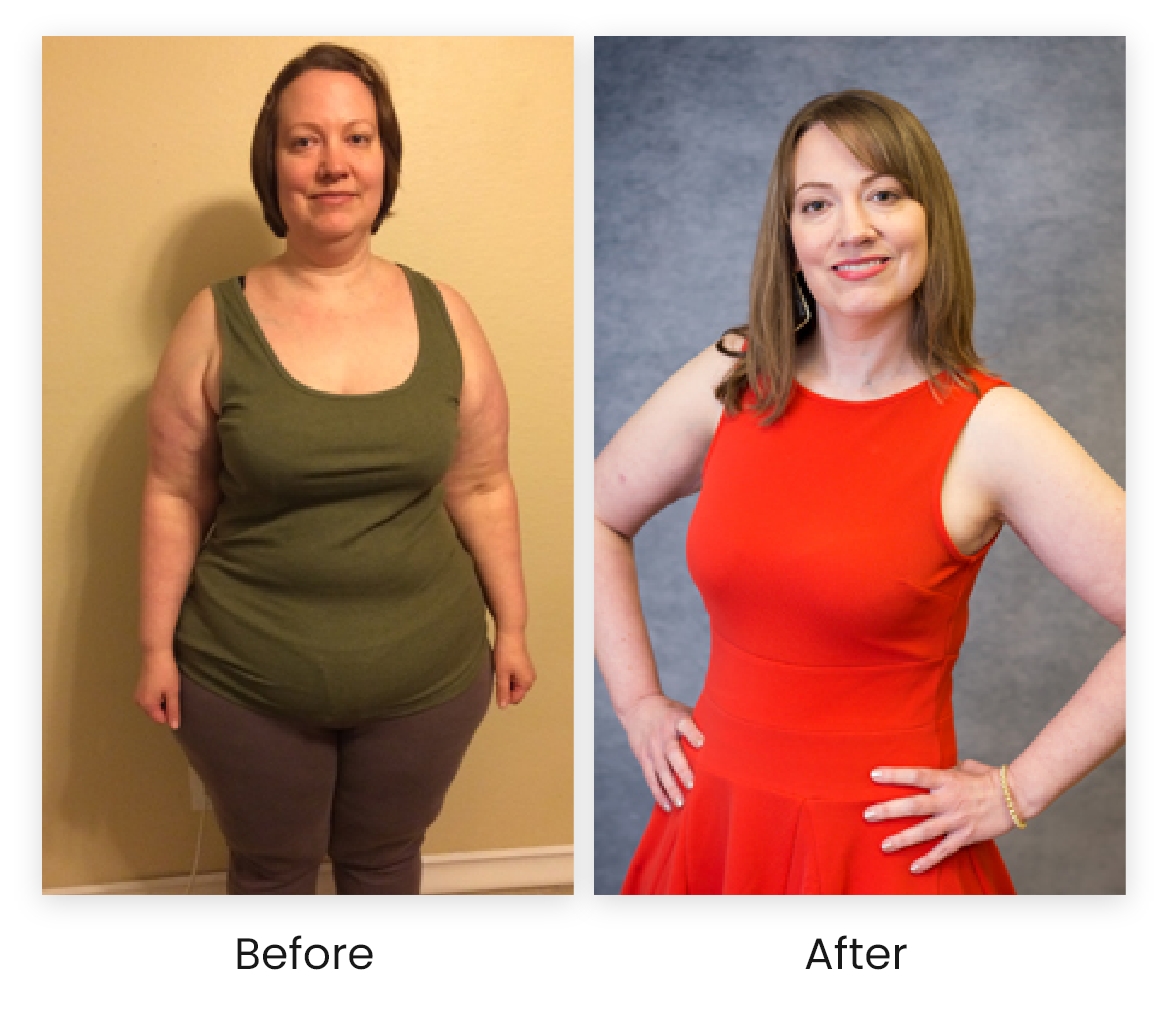 Before and After of medical weight loss