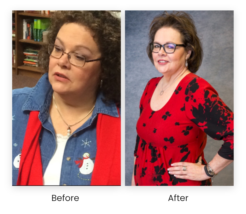 Before and After of medication for weight loss